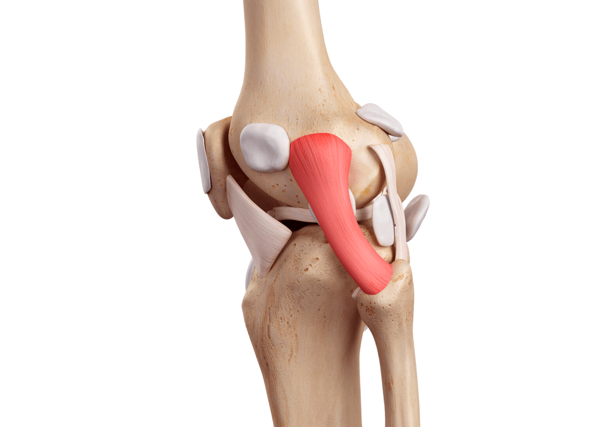 Image of a knee joint (anatomically).